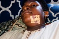 Mâchoire cassée par des militaires lors des manifestations : Nayed, 14 ans, a besoin de votre aide